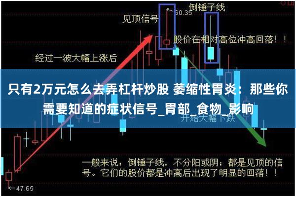只有2万元怎么去弄杠杆炒股 萎缩性胃炎：那些你需要知道的症状信号_胃部_食物_影响